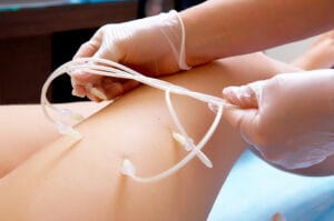 озоновое лечение